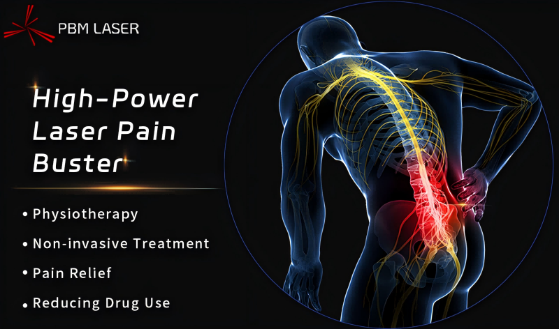 Laser y tế PBM 丨 Mở khóa mã phục hồi chức năng, Laser công suất cao nhận được khuyến nghị hạng A trong Hướng dẫn chẩn đoán và điều trị đau thắt lưng mãn tính của Trung Quốc (Phiên bản 2024)